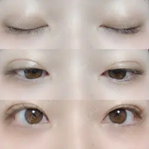 口コミ