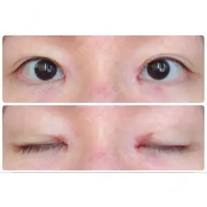 いちのせ形成外科・皮膚科 眼瞼＆フェイスクリニック口コミ