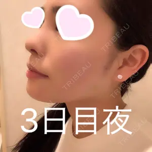 TCB東京中央美容外科 TCB東京中央美容外科 心斎橋院口コミ