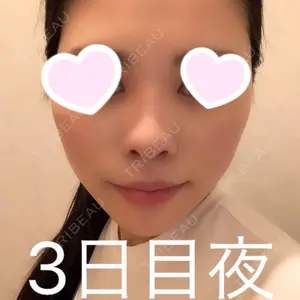TCB東京中央美容外科 TCB東京中央美容外科 心斎橋院口コミ