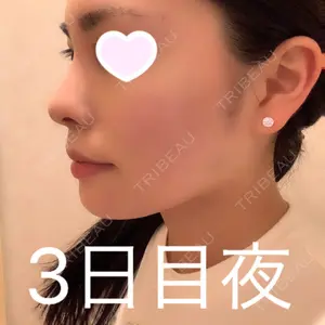 TCB東京中央美容外科 TCB東京中央美容外科 心斎橋院口コミ