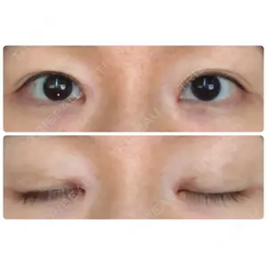 いちのせ形成外科・皮膚科 眼瞼＆フェイスクリニック口コミ