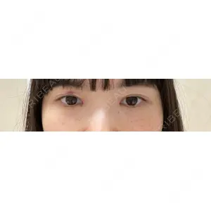 グローバルビューティークリニック 東京院の