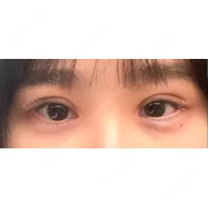 いちのせ形成外科・皮膚科 眼瞼＆フェイスクリニック口コミ