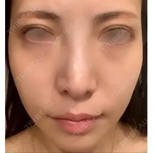 VENUS BEAUTY CLINIC　銀座院口コミ