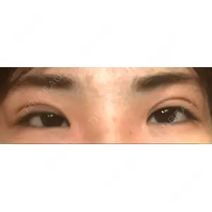 東京BELLEZZAクリニック口コミ
