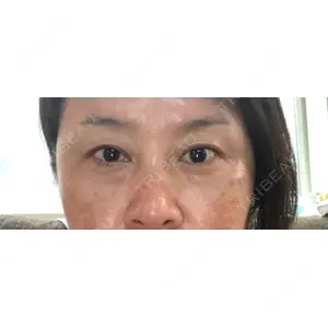 TCB東京中央美容外科 TCB東京中央美容外科 町田院口コミ