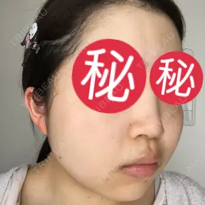 南青山TOKUNAKAクリニック口コミ