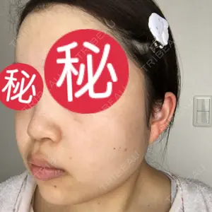 南青山TOKUNAKAクリニック口コミ