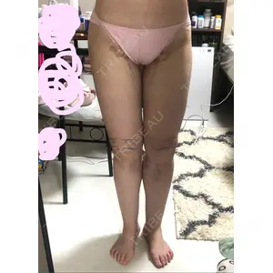 オアシス美容外科口コミ