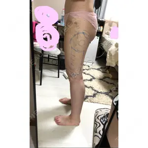 オアシス美容外科口コミ