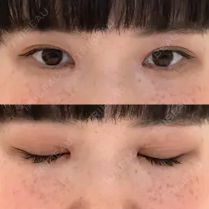 グローバルビューティークリニック 東京院の