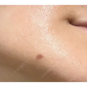 Jスキンクリニック 【J-SKIN clinic】口コミ