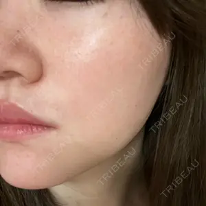 南青山TOKUNAKAクリニック口コミ