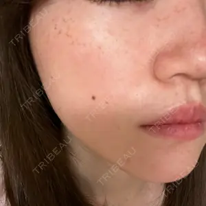 南青山TOKUNAKAクリニック口コミ