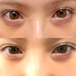 APOLLO BEAUTY CLINIC口コミ