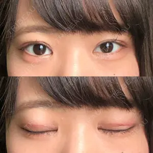 東京皮膚科・形成外科 東京皮膚科・形成外科 (銀座いけだクリニック)口コミ