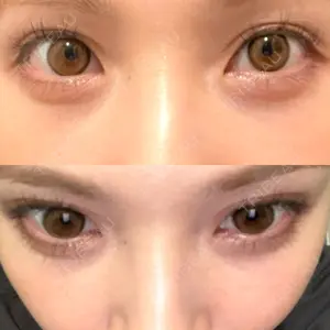 APOLLO BEAUTY CLINIC口コミ