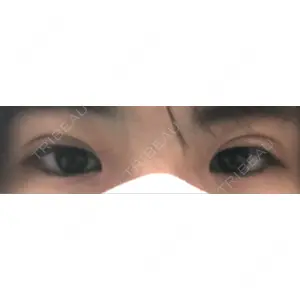 東京BELLEZZAクリニック口コミ
