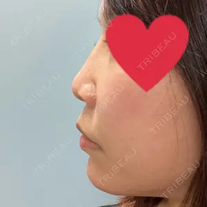 口コミ