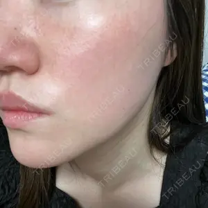 南青山TOKUNAKAクリニック口コミ