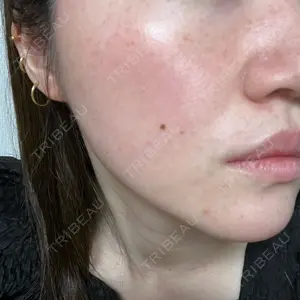 南青山TOKUNAKAクリニック口コミ
