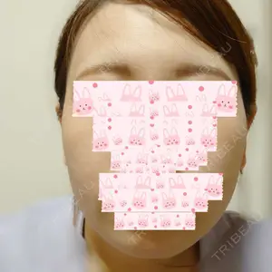 TCB東京中央美容外科 TCB東京中央美容外科 神戸院口コミ