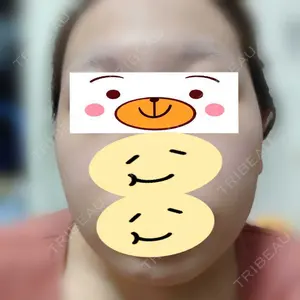 TCB東京中央美容外科 TCB東京中央美容外科 神戸院口コミ