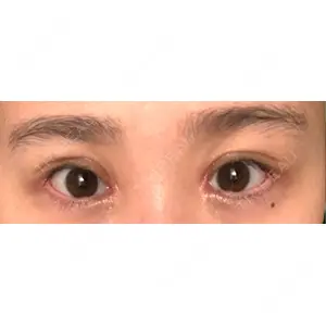 いちのせ形成外科・皮膚科 眼瞼＆フェイスクリニック口コミ