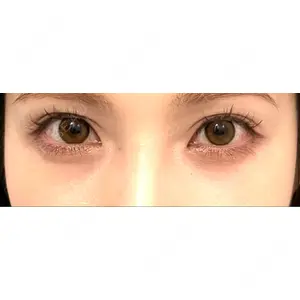APOLLO BEAUTY CLINIC口コミ