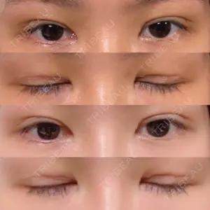 口コミ