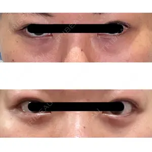APOLLO BEAUTY CLINIC口コミ