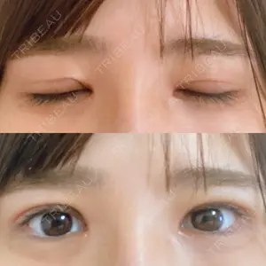 いちのせ形成外科・皮膚科 眼瞼＆フェイスクリニック口コミ