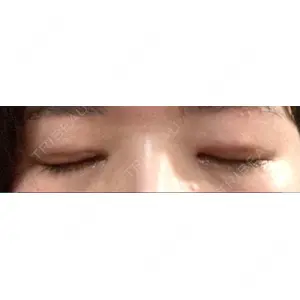いちのせ形成外科・皮膚科 眼瞼＆フェイスクリニック口コミ