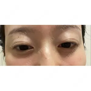 TCB東京中央美容外科 TCB東京中央美容外科 銀座有楽町院口コミ