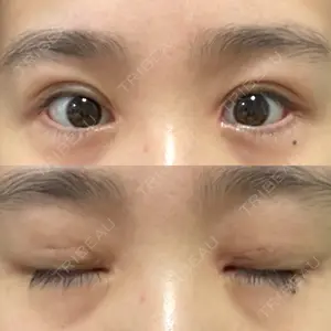 いちのせ形成外科・皮膚科 眼瞼＆フェイスクリニック口コミ