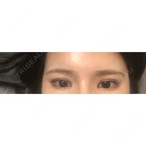 東京BELLEZZAクリニック口コミ