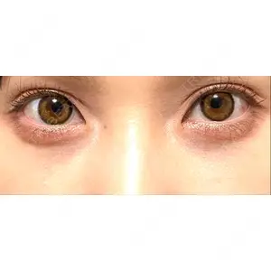 APOLLO BEAUTY CLINIC口コミ