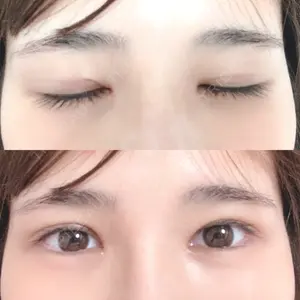 いちのせ形成外科・皮膚科 眼瞼＆フェイスクリニック口コミ