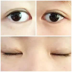 口コミ