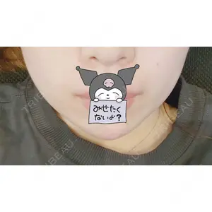 フィラークリニック フィラークリニック 名古屋栄院口コミ