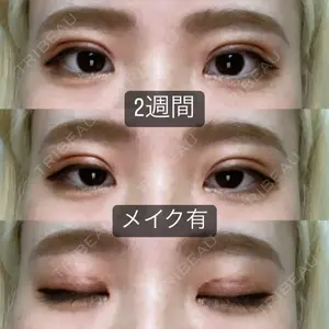 口コミ