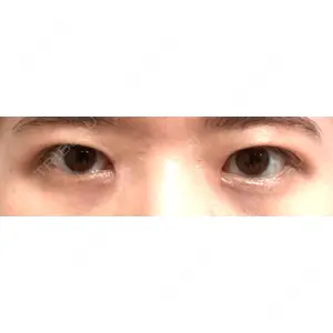 いちのせ形成外科・皮膚科 眼瞼＆フェイスクリニック口コミ