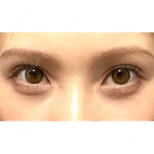 APOLLO BEAUTY CLINIC口コミ