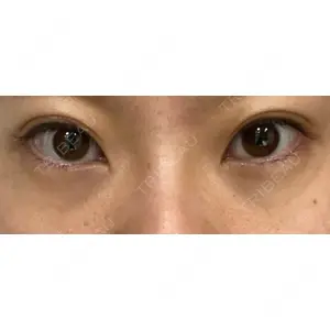 APOLLO BEAUTY CLINIC口コミ