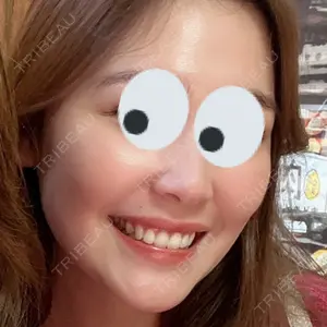 TCB東京中央美容外科 TCB東京中央美容外科 町田院口コミ