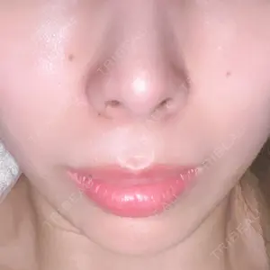 口コミ