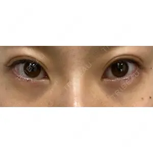APOLLO BEAUTY CLINIC口コミ