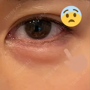 渋谷美容外科クリニック 渋谷美容外科クリニック 池袋院口コミ