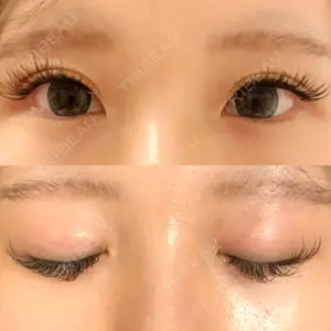 東京BELLEZZAクリニック口コミ